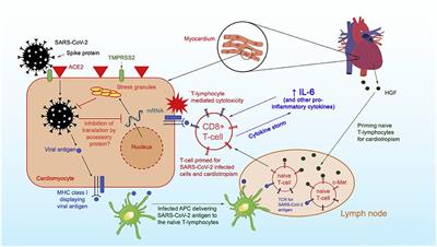 Review of COVID-19 Myocarditis in Competitive Athletes: Legitimate Concern or Fake News?